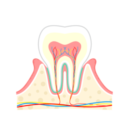 軽度歯周炎（P1）
